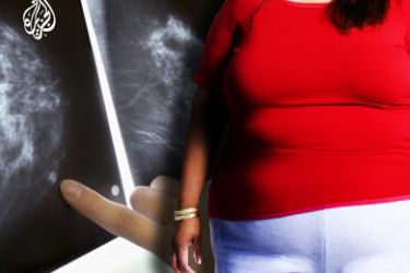 النساء زائدات الوزن أقل تعرضا لسرطان الثدي قبل سن اليأس