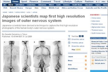 The first high resolution photographs of the human body's outer nervous system by scientists at Tokai University, Japan and Utrecht University, Netherlands