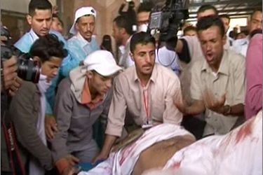 لليوم الثالث على التوالي شهدت عدة أنحاء من اليمن صدامات دامية بين معتصمين مناهضين للرئيس علي عبد الله صالح يطالبون بتنحيه وقوات أمن وعناصر مسلحة بلباس مدني. وكانت اشتباكات أمس الثلاثاء في صنعاء وتعز قد خلفت عشرات الإصابات بين جريح وقتيل.