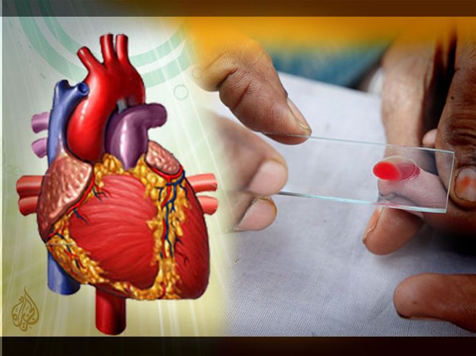 فصيلة الدم قد تُزيد خطر الإصابة بأمراض القلب