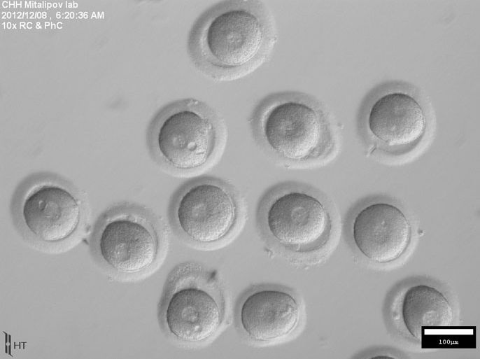 epa03703875 A photo provided by the Oregon Health & Science University shows early stage cells as they grow from human skin cells into embryonic stem cells. Scientists at the university and the Oregon National Primate Research Center (ONPRC) have successfully reprogrammed human skin cells to become embryonic stem cells capable of transforming into any other cell type in the body. The research was led by Shoukhrat Mitalipov and follows the 2007 success in transforming monkey skin cells into embryonic stem cells. EPA/OREGON HEALTH & SCIENCE UNIVERSITY HANDOUT EDITORIAL USE ONLY