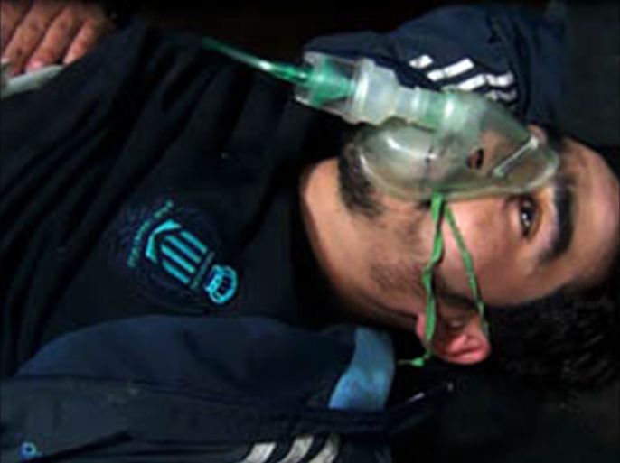أحد المصابين بالغازات الكيماوية السامة-شبح الكيماوي يخيم مجددا على الغوطة الشرقية