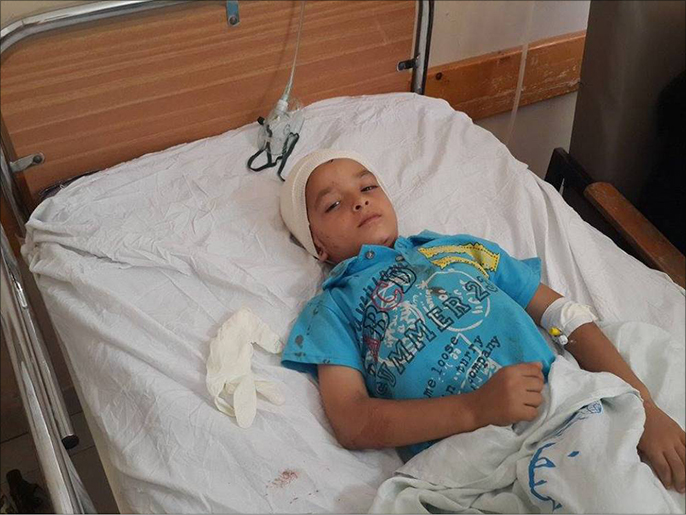 ‪بركة أصيب بشظية برأسه واستشهد والده في قصف إسرائيلي لمنزله‬ (الجزيرة)