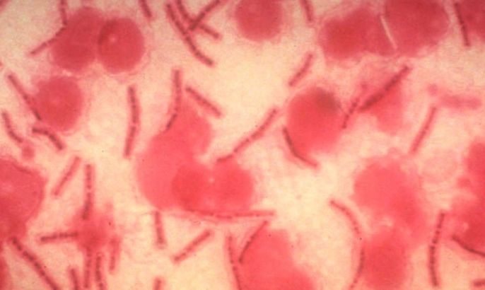 395395 01: A microscopic view of stained anthrax bacteria in an undated photo from the Command at Fort Detrick, Md. A Florida man has been hospitalized with inhalation anthrax. Authorities have discounted terrorism as the cause of the bacterial infection in Florida. (Photo Courtesy of U.S. Army Medical Research and Development/Getty Images)