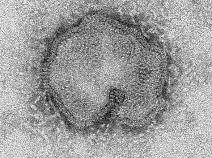 This Monday, April 15, 2013 electron microscope image provided by the Centers for Disease Control and Prevention shows the H7N9 virus which can take on a variety of shapes. Almost three weeks after China reported finding a new strain of bird flu in humans, experts are still stumped by how people are becoming infected when many appear to have had no recent contact with live fowl and the virus isn't supposed to pass from person to person. Understanding how the H7N9 bird flu virus is spreading is a goal of international and Chinese experts assembled by the World Health Organization as they begin a weeklong investigation Friday, April 18, 2013.