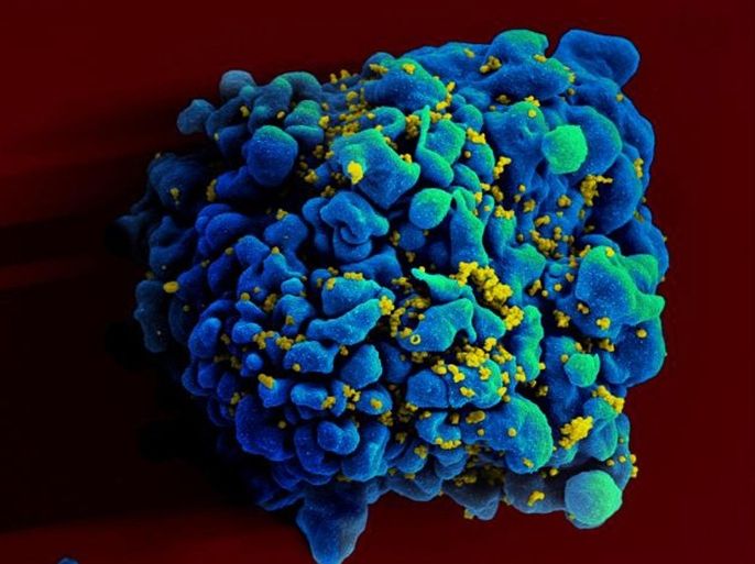 This April 12, 2011 electron microscope image made available by the National Institute of Allergy and Infectious Diseases shows an H9 T cell, colored in blue, infected with the human immunodeficiency virus (HIV), yellow. Doctors may one day be able to control a patient s HIV infection in a new way: injecting swarms of germ-fighting antibodies, two new studies suggest. Reports by Dr. Dan Barouch of Harvard and the Beth Israel Deaconess Medical Center in Boston and the National Institutes of Health were published Wednesday, Oct. 30, 2013 in the journal Nature.