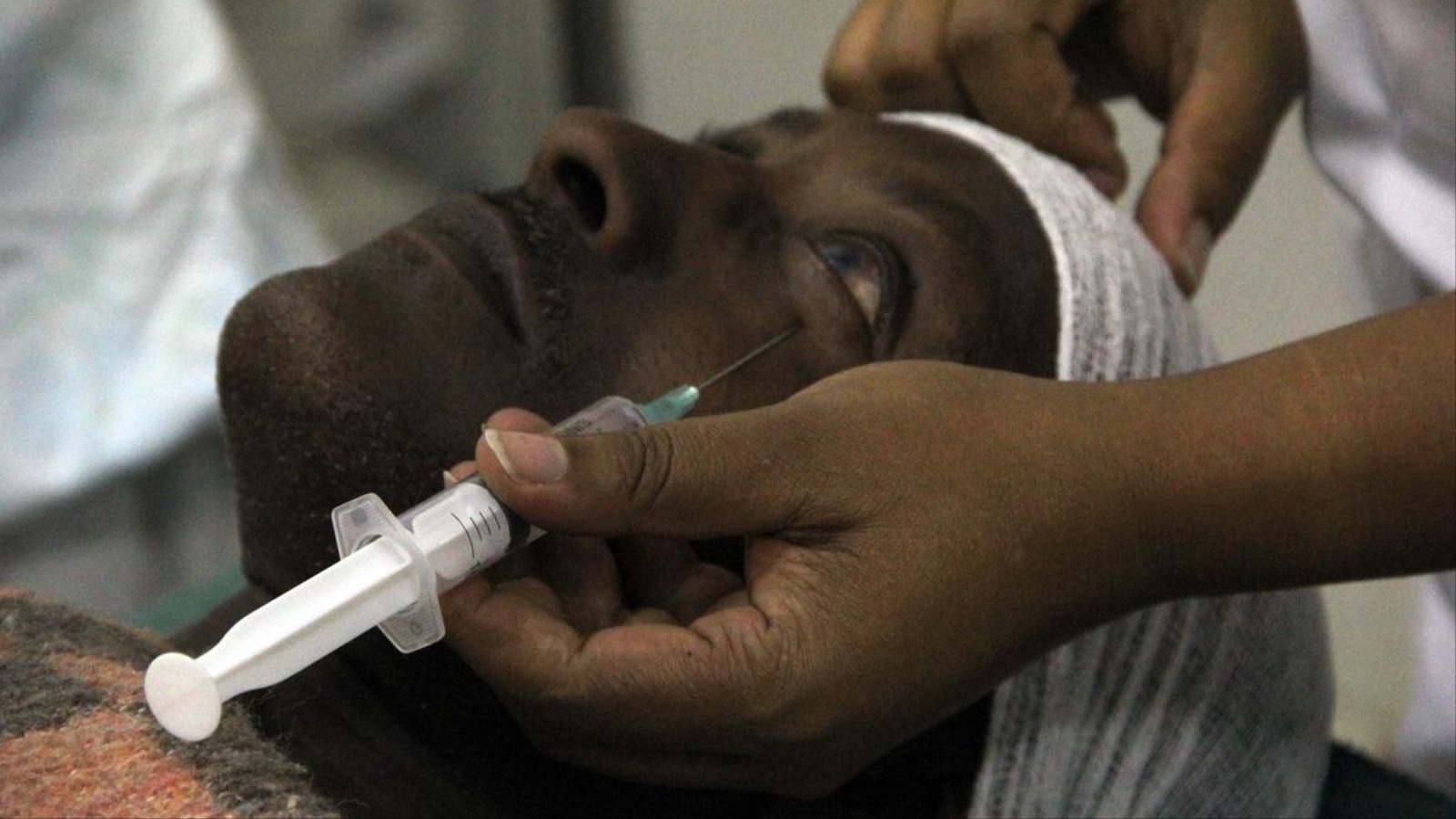 أكثر من ثلاثمئة ألف إثيوبي يعانون من تلف بالقرنية نتيجة سوء العناية بالعيون والفقر (الأناضول)