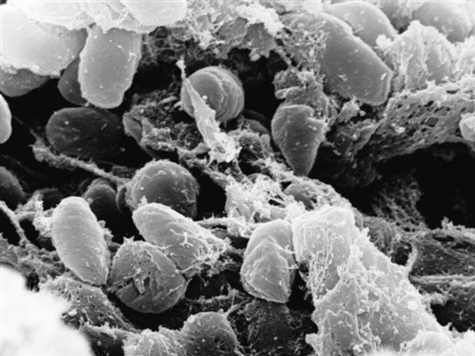 Undated handout image provided by Rocky Mountain Laboratories showing an electron micrograph depicting a mass of Yersinia pestis bacteria (the cause of bubonic plague).