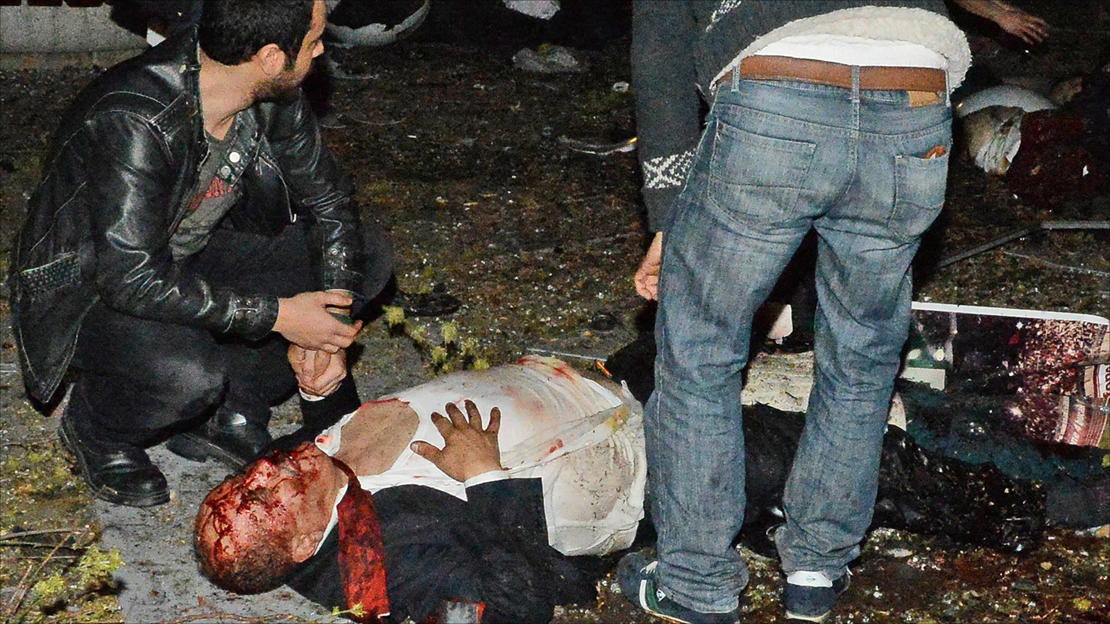 ‪عدد من جرحى تفجير أنقرة حالتهم حرجة وهو ما يشير إلى احتمال ارتفاع حصيلة القتلى‬ (الأوروبية)