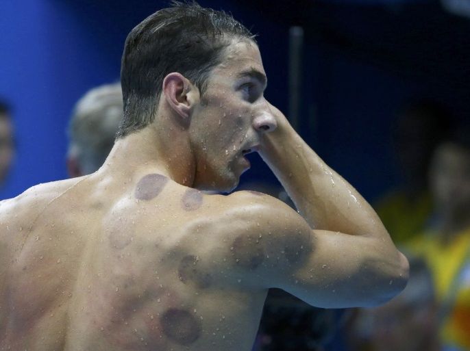 2016 Rio Olympics - Swimming - Preliminary - Men's 200m Butterfly - Heats - Olympic Aquatics Stadium - Rio de Janeiro, Brazil - 08/08/2016. Michael Phelps (USA) of USA is seen with red cupping marks on his shoulder as he competes. REUTERS/Michael Dalder FOR EDITORIAL USE ONLY. NOT FOR SALE FOR MARKETING OR ADVERTISING CAMPAIGNS.