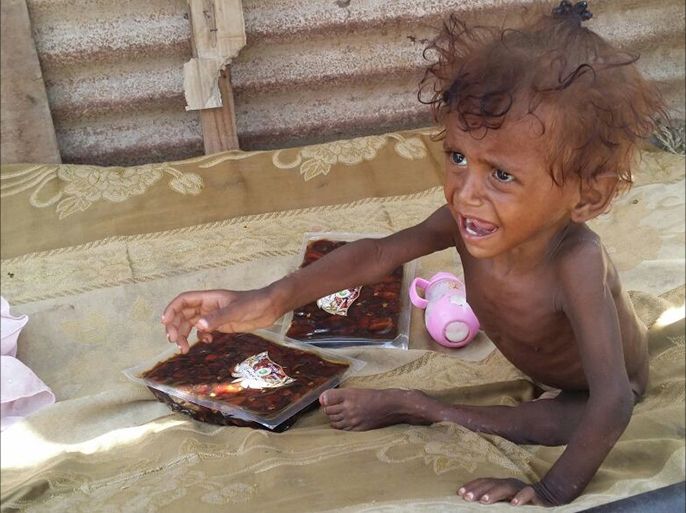 المجاعة تهدد أطفال اليمن - (الصور من منظمات انسانسة)