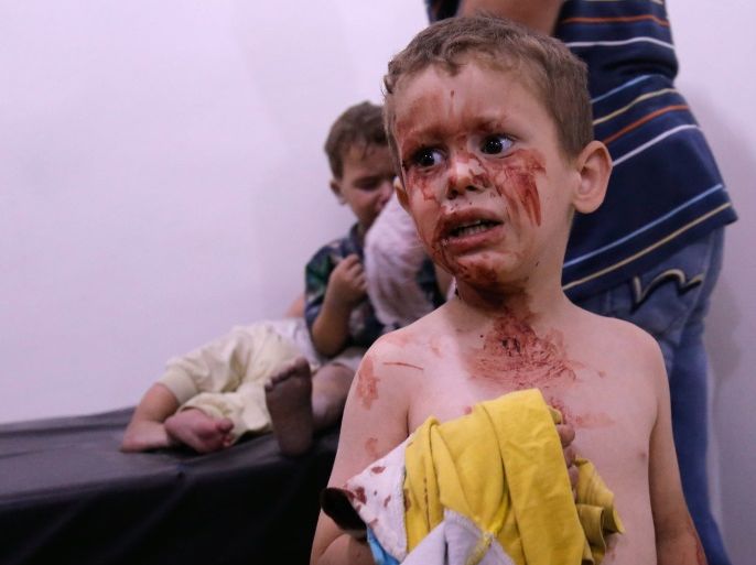 EDITORS NOTE: Graphic content / A Syrian child looks on ashe waits to receive treatment at a make-shift hospital after he was injured in shelling on the rebel-held town of Arbin, east of the capital, late on July 24, 2017. Women and children were among the dead in the 11:30 pm (2030 GMT) strike on Arbin in the Eastern Ghouta rebel enclave where the government declared a ceasefire on July 22, the Syrian Observatory for Human Rights said. / AFP PHOTO / ABDULMONAM EASSA
