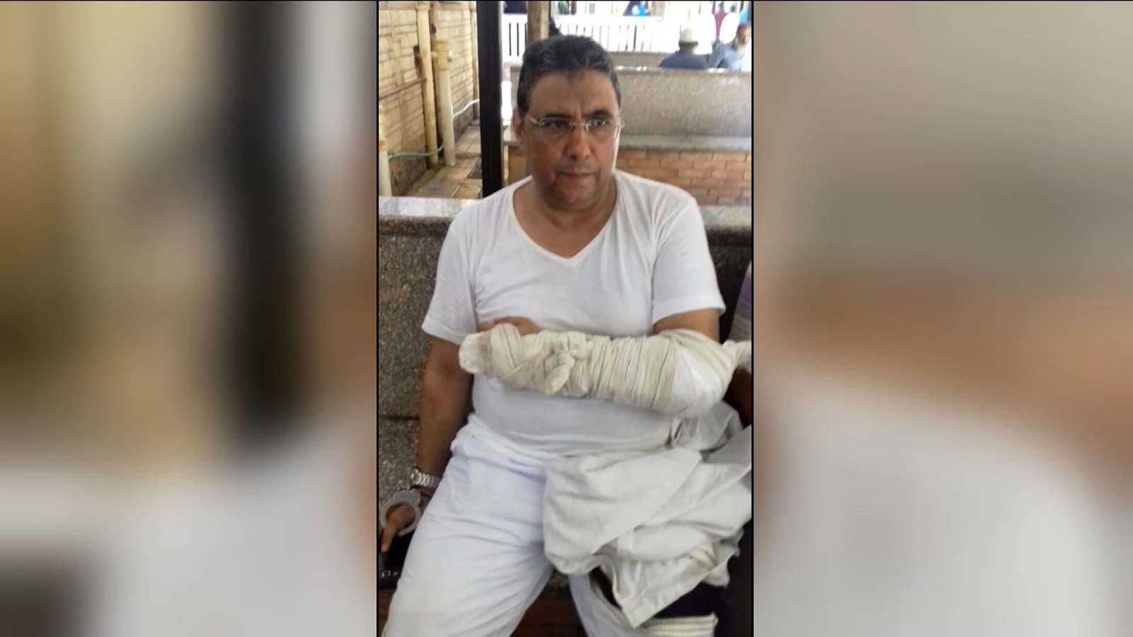 الزميل محمود حسين بعد أن تعرض لكسر مضاعف في يده اليسرى، ولم تسمح له سلطات المعتقل بالعلاج  (الجزيرة)