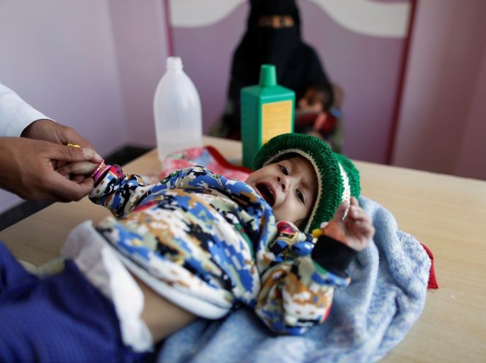 A girl is being treated at a malnutrition treatment center in Sanaa, Yemen November 4, 2017. REUTERS/Khaled Abdullah