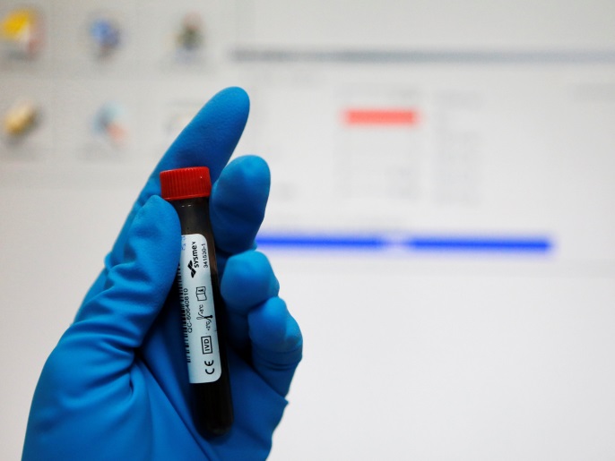 A technician holds a test tube with a blood sample at the Russian anti-doping laboratory in Moscow, Russia, May 24, 2016. REUTERS/Sergei Karpukhin