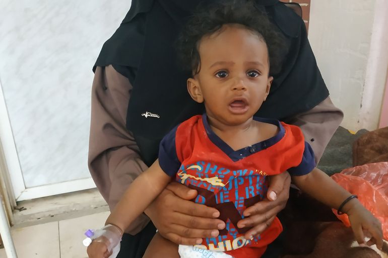 طفل مصاب بالكوليرا- مركز الكوليرا- مستشفى السبعين - صنعاء