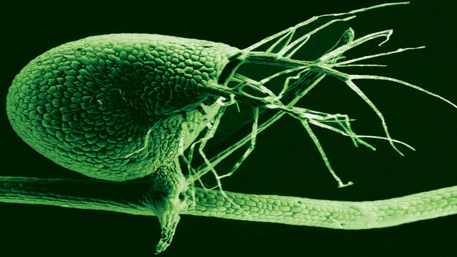‪صورة مجهرية لمثانة نبات 