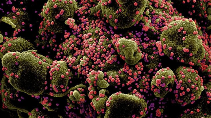 Colorized scanning electron micrograph of an apoptotic cell (greenish brown) heavily infected with SARS-COV-2 virus particles (pink) isolated from a patient sample. (REUTERS)