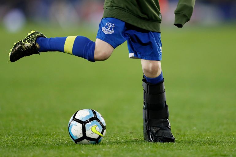 Everton v Crystal Palace - Premier League Britain Football Soccer - Everton v Crystal Palace - Premier League - Goodison Park - 30/9/16 General view of an Everton mascot playing football at half time with a broken leg Action Images via Reuters / Carl Recine Livepic EDITORIAL USE ONLY. No use with unauthorized audio, video, data, fixture lists, club/league logos or "live" services. Online in-match use limited to 45 images, no video emulation. No use in betting, games or single club/league/player publications. Please contact your account representative for further details.