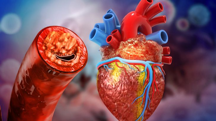 Human heart anatomy and clogged arteries. 3d illustration الكوليسترول