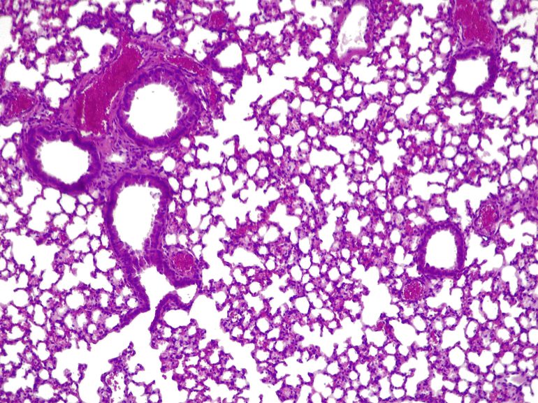 CAPTION This shows a cross-section of a mouse lung infected with Pseudonomas aeruginosa. The mouse was treated with a version of Mycoplasma pneumoniae that is able to produce therapeutic molecules such as pyocins specifically-designed to combat P. aeruginosa. This therapeutic version of M. pneumoniae acts like a ‘living medicine’ reducing the effects of the infection and preserving air in the alveoli. CREDIT Rocco Mazzolini/CRG